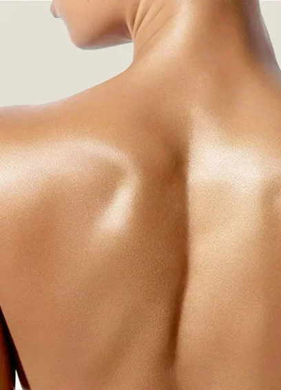 Lipoescultura de Espalda